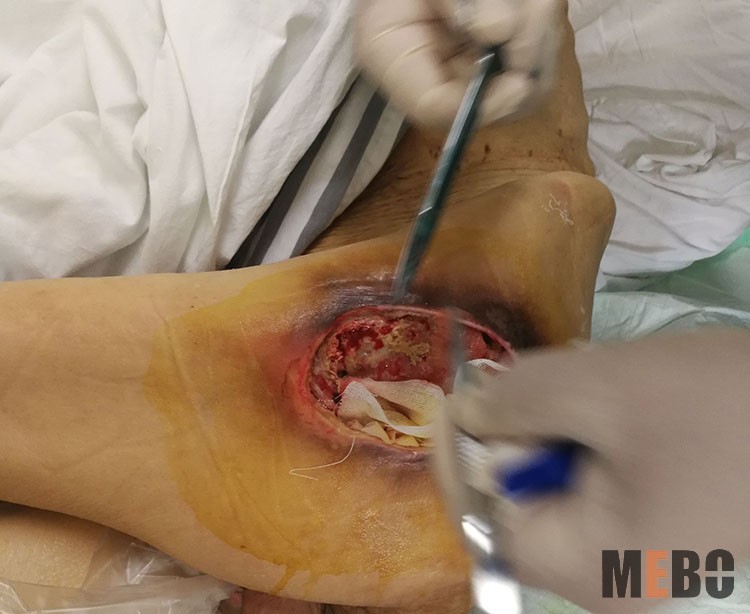 ����˹����ᡤ(�й�)����