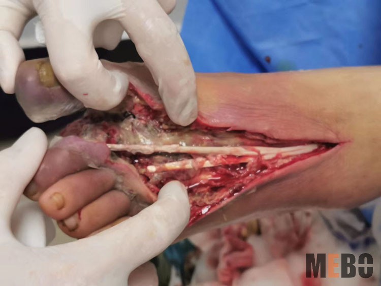 ����˹����ᡤ(�й�)����