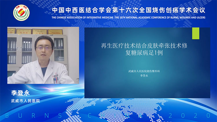 ����˹����ᡤ(�й�)����