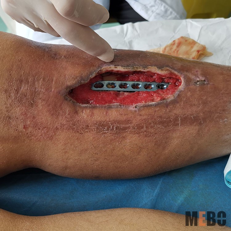 ����˹����ᡤ(�й�)����