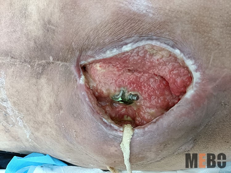 ����˹����ᡤ(�й�)����