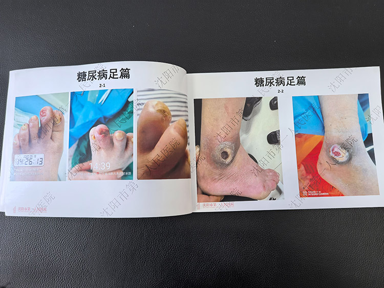 ����˹����ᡤ(�й�)����