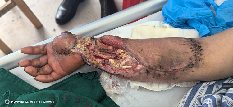 ����˹����ᡤ(�й�)����