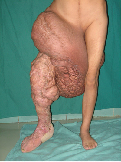 2009319925725101