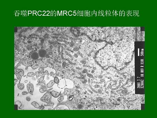 ����˹����ᡤ(�й�)����