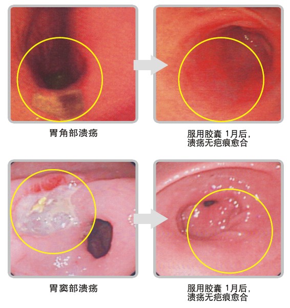 ����˹����ᡤ(�й�)����