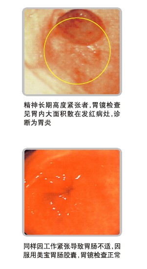 ����˹����ᡤ(�й�)����