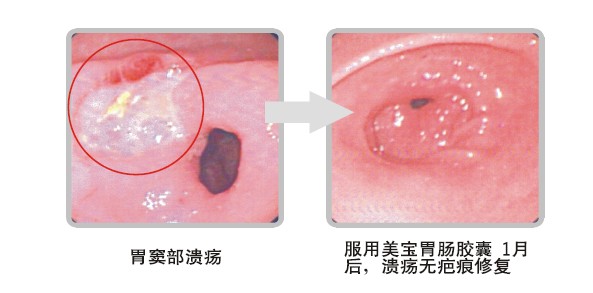 ����˹����ᡤ(�й�)����