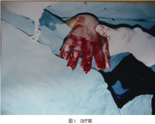 ����˹����ᡤ(�й�)����