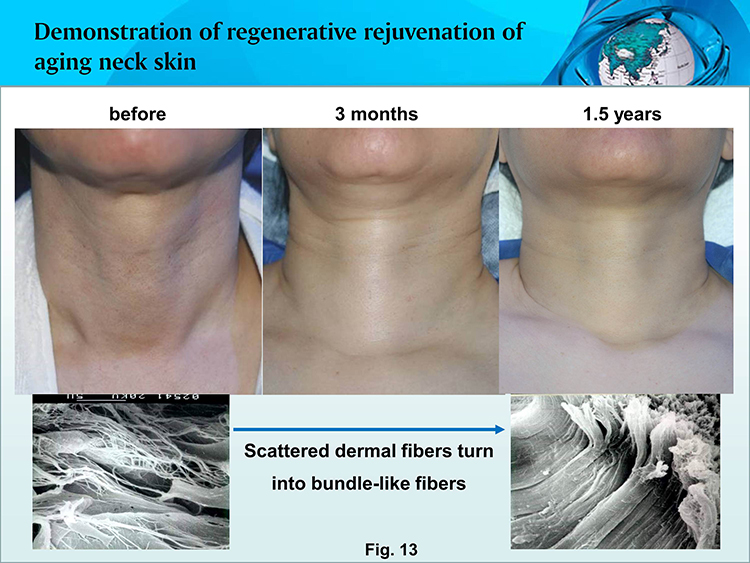 ����˹����ᡤ(�й�)����